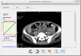 Free DICOM Viewer screenshot 1